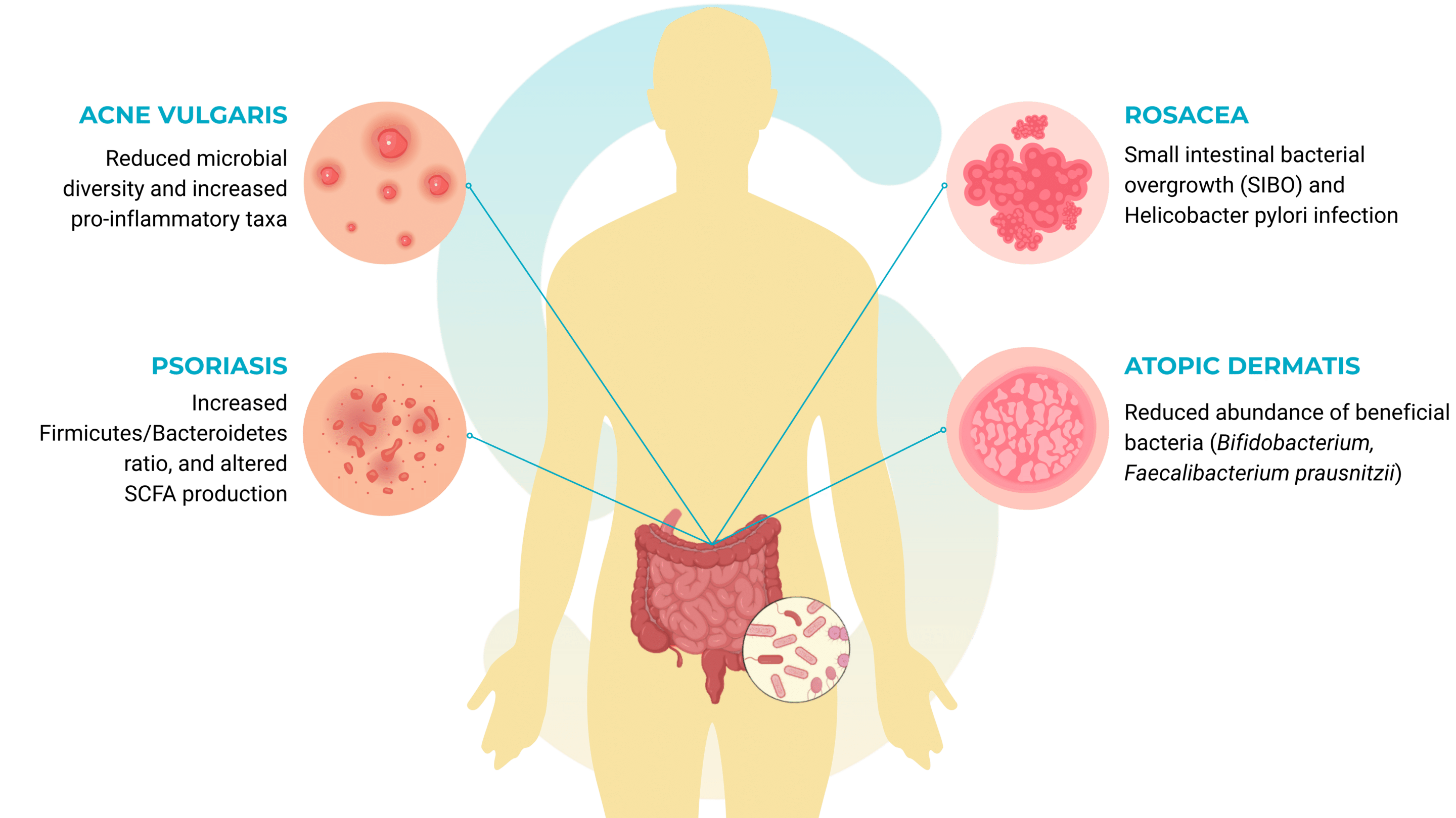 Gut-skin-axis-acne-psoriasis-dermatis-rosacea