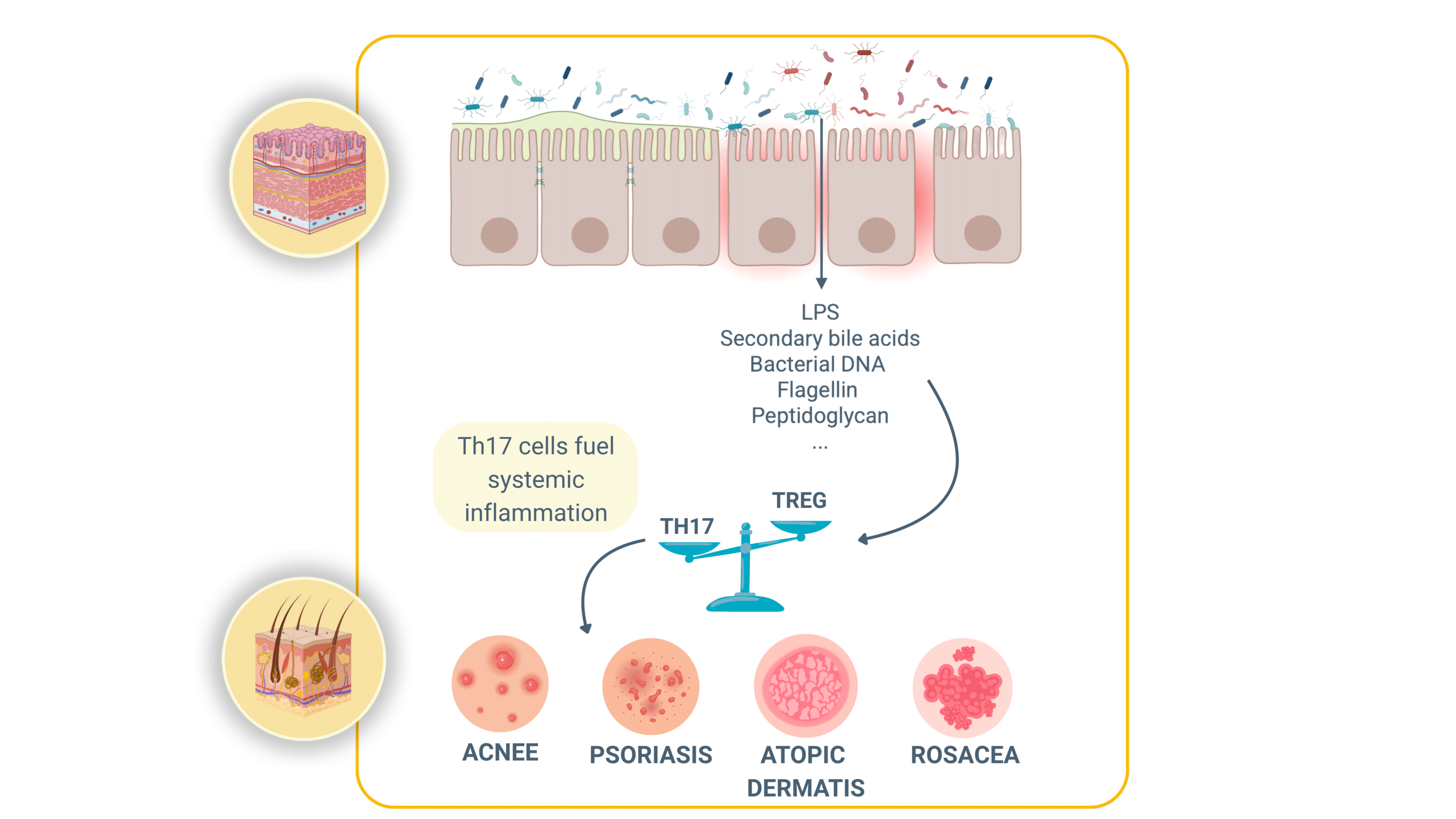 Gut-skin-inflammation-disbiosys